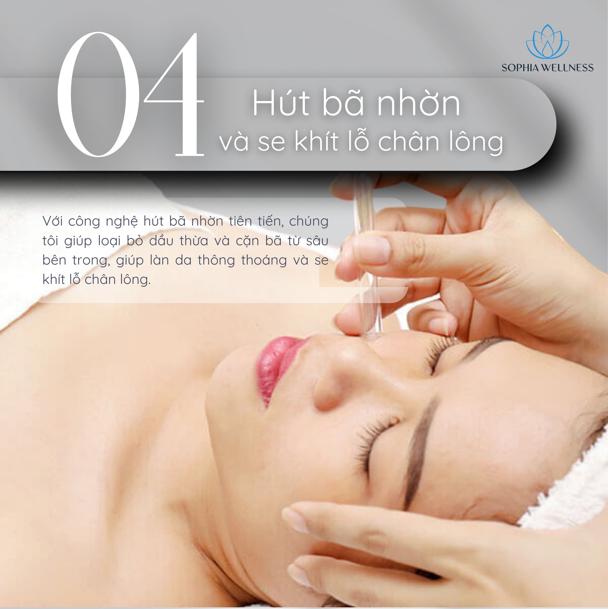 Hút bã nhờn và se khít lỗ chân lông