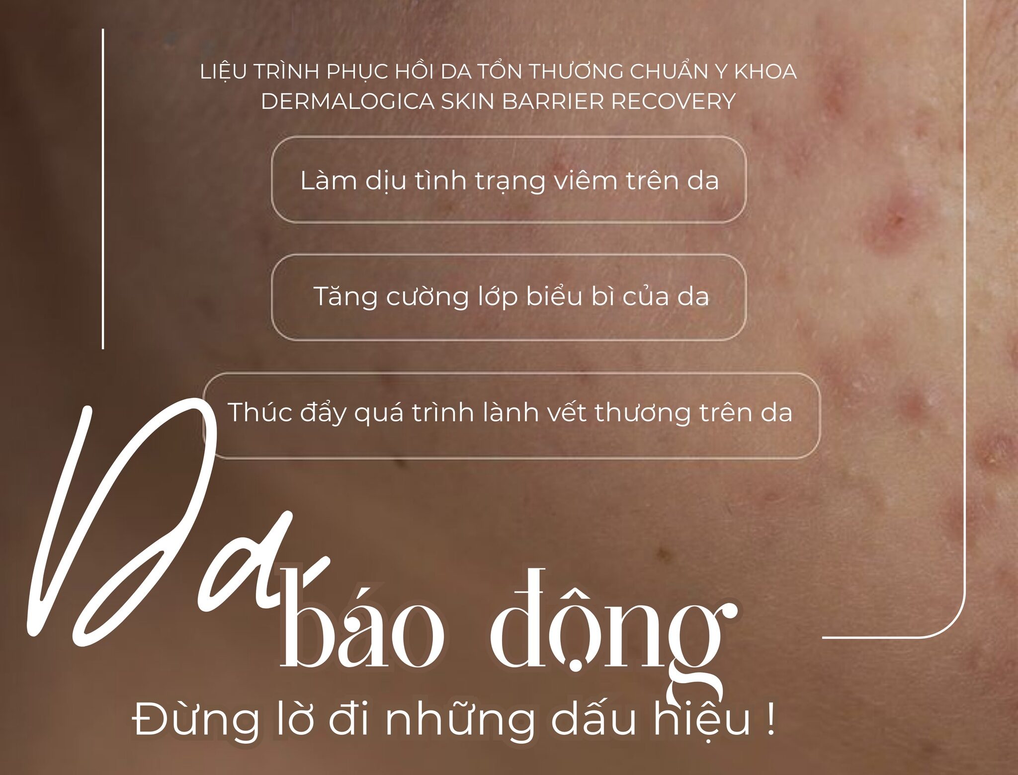 DA MẶT BÁO ĐỘNG – BẠN CÓ ĐANG BỎ QUÊN TÍN HIỆU NÀY?