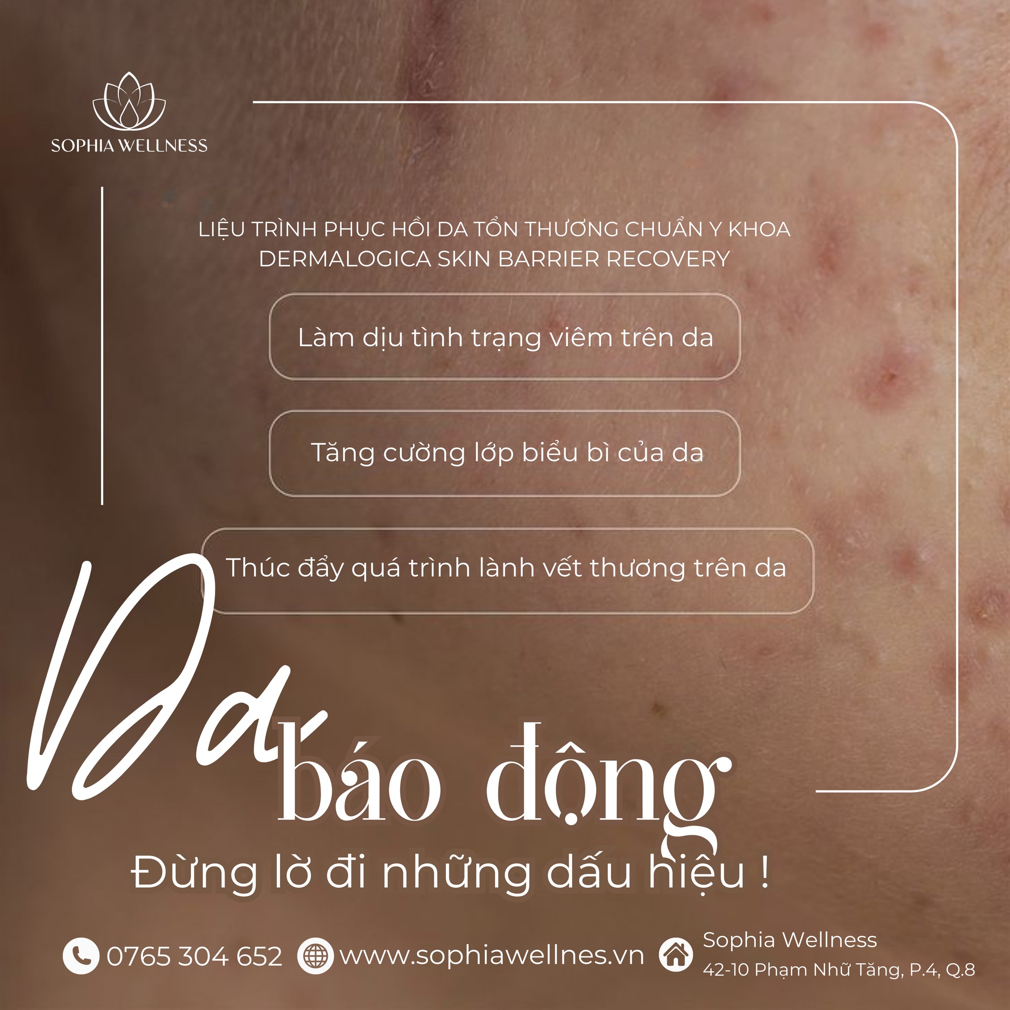 DA MẶT BÁO ĐỘNG – BẠN CÓ ĐANG BỎ QUÊN TÍN HIỆU NÀY?