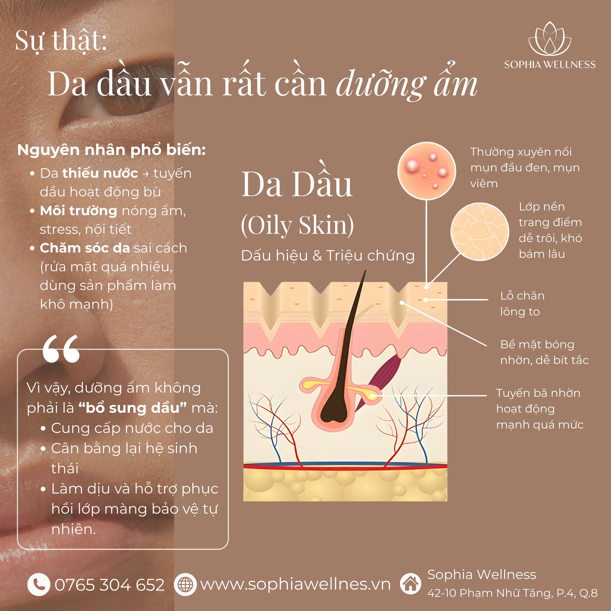 Da Dầu Có Cần Dưỡng Ẩm Không? – Câu Trả Lời Khiến Bạn Bất Ngờ!
