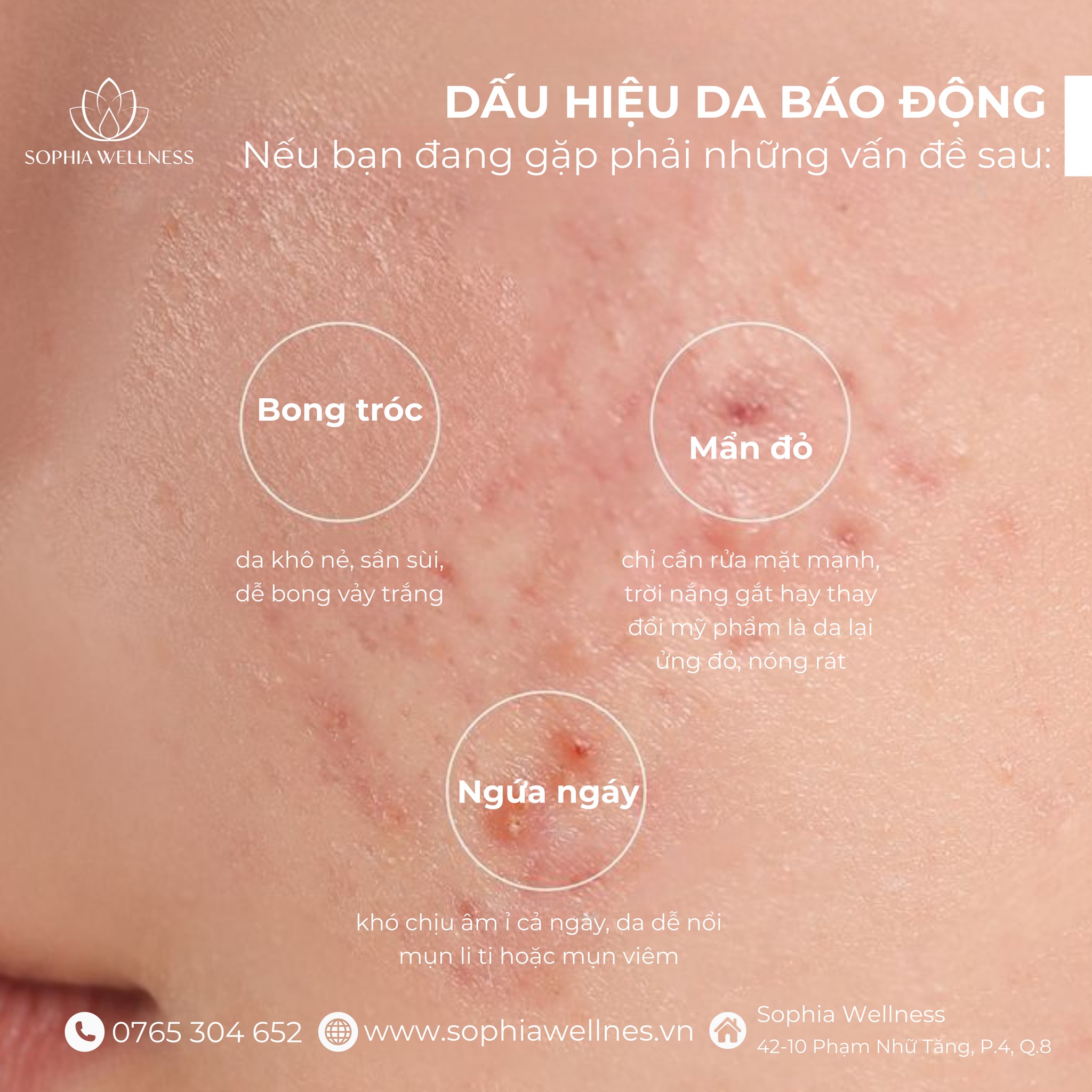 DA MẶT BÁO ĐỘNG – BẠN CÓ ĐANG BỎ QUÊN TÍN HIỆU NÀY?
