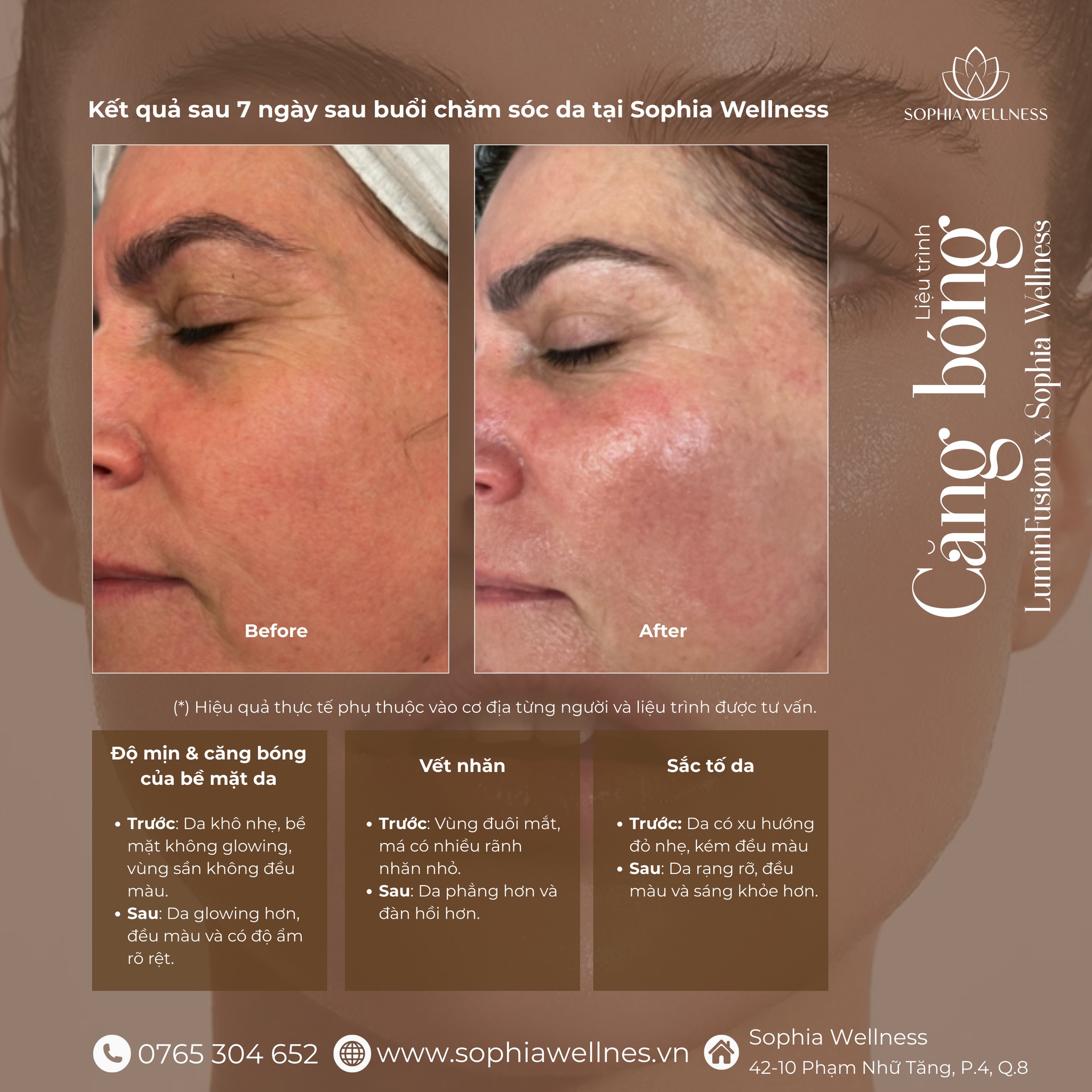 RẠNG RỠ, CĂNG BÓNG - TỰ TIN KHOE DA MÀ KHÔNG CẦN MAKEUP