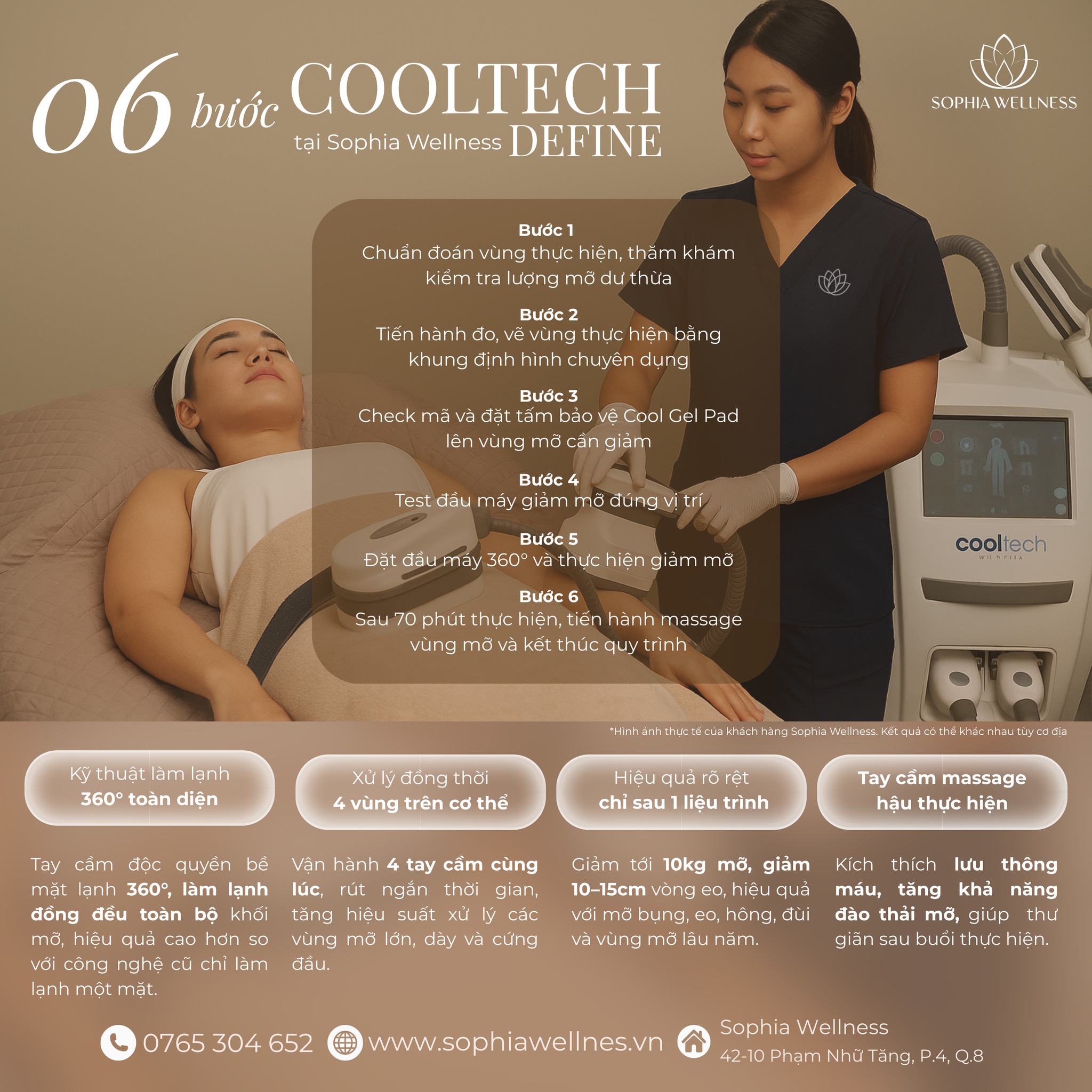 Thon gọn cấp tốc sau 1 buổi với COOLTECH DEFINE – Công nghệ đông huỷ mỡ 360° thế hệ mới