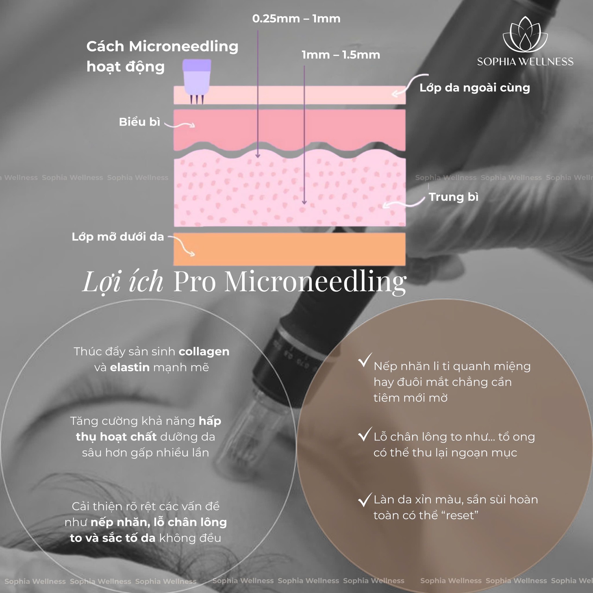 PRO MICRONEEDLING – “THỨC TỈNH” COLLAGEN, ĐÁNH THỨC LÀN DA